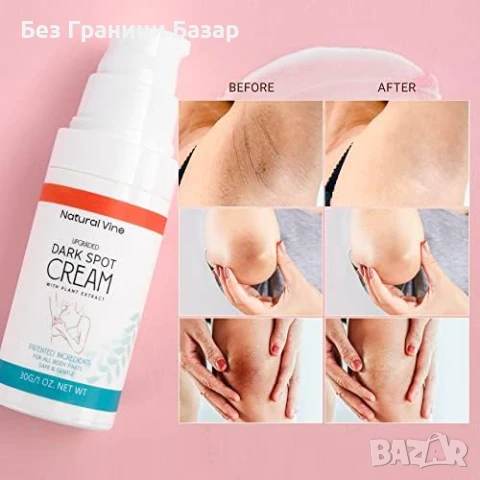 Нов Изсветляващ крем за лице и тяло – лунички, петна, слънце против тъмни петна, снимка 6 - Козметика за лице - 51128501