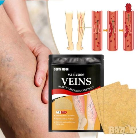 Детокс Лепенки за Разширени Вени Варикозни Капиляри Варикоза Флебит Атеросклероза Тежки Подути Крака, снимка 13 - Други - 41329206